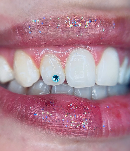 Gema dental blava, treball de Geor